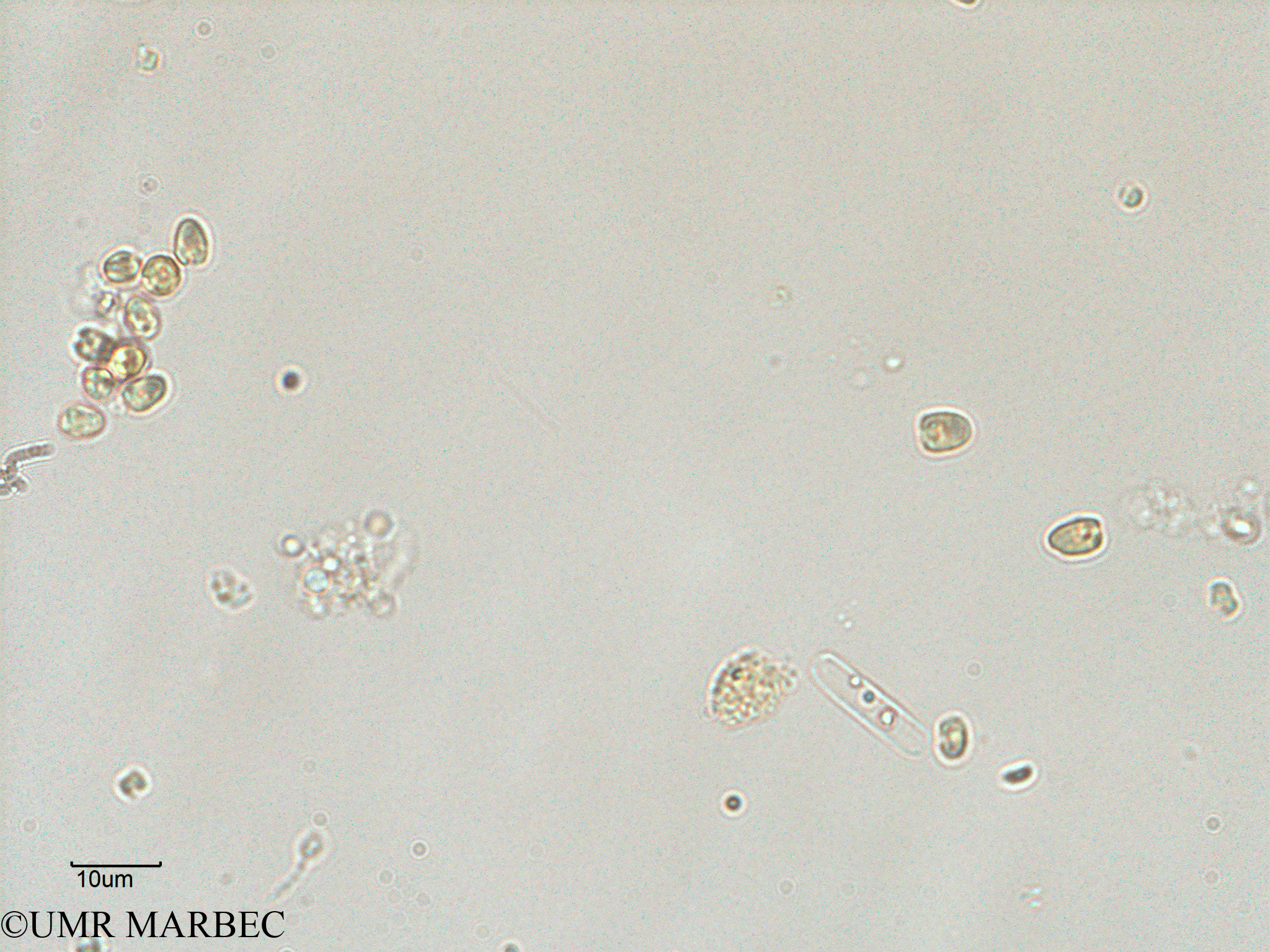 phyto/Scattered_Islands/juan_de_nova/COMMA2 November 2013/Nanoflagellé 9 (ancien Flagellé 2-8).tif(copy).jpg